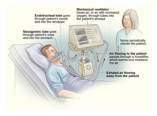 cara kerja ventilator