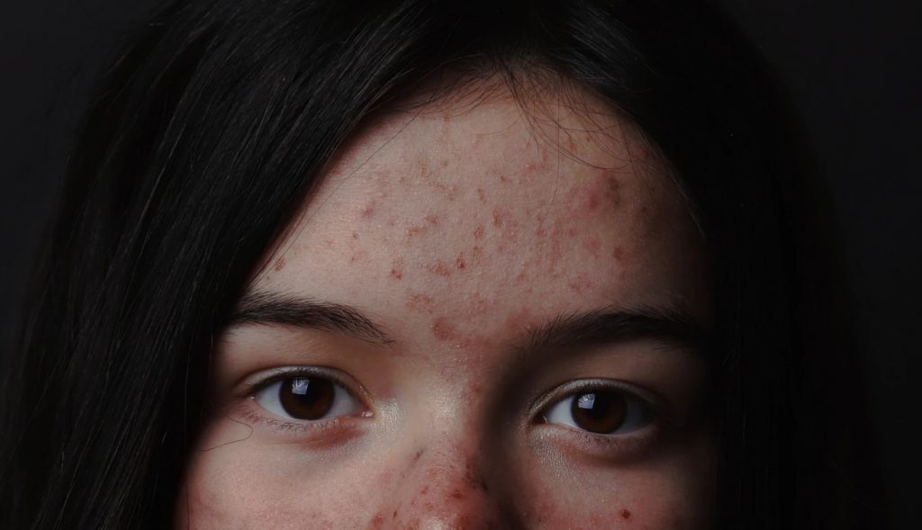 MANFAAT MASKER MADU