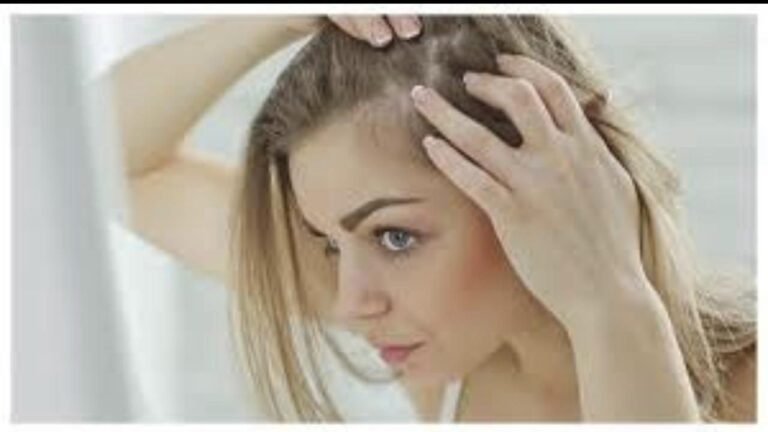 Sejumlah Faktor yang Mempengaruhi Pertumbuhan Rambut